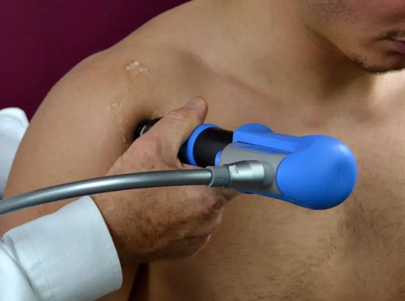 Shockwave Therapy Treatment